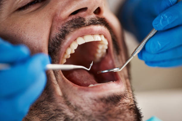 Best Dentist for Tooth Abscess  in Nottingham, PA